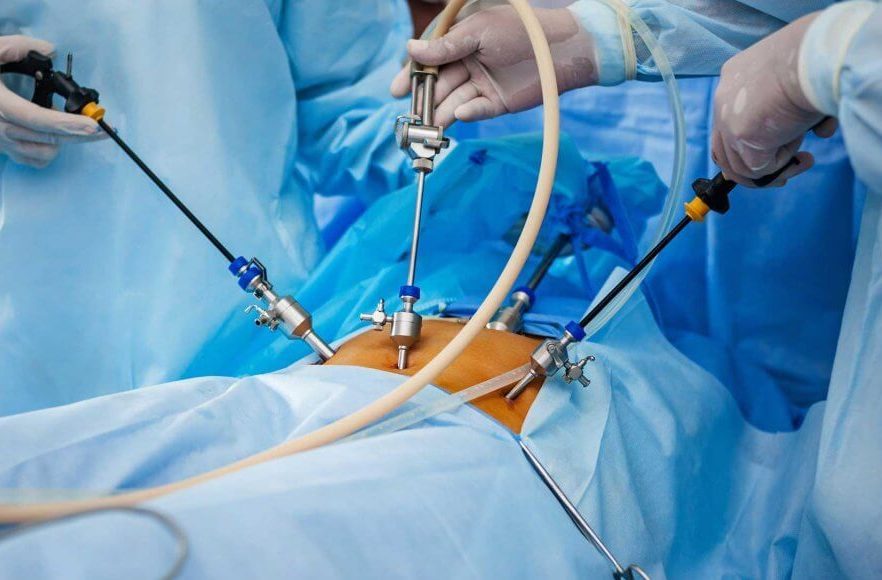 laparoscopic surgery in mumbai