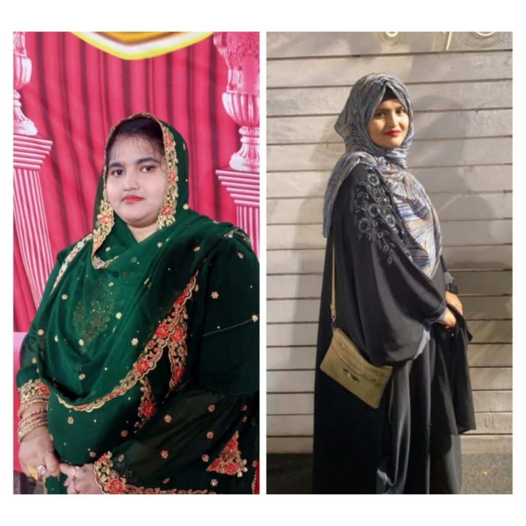 dr-pradeep-bariatric-surgery-before-after