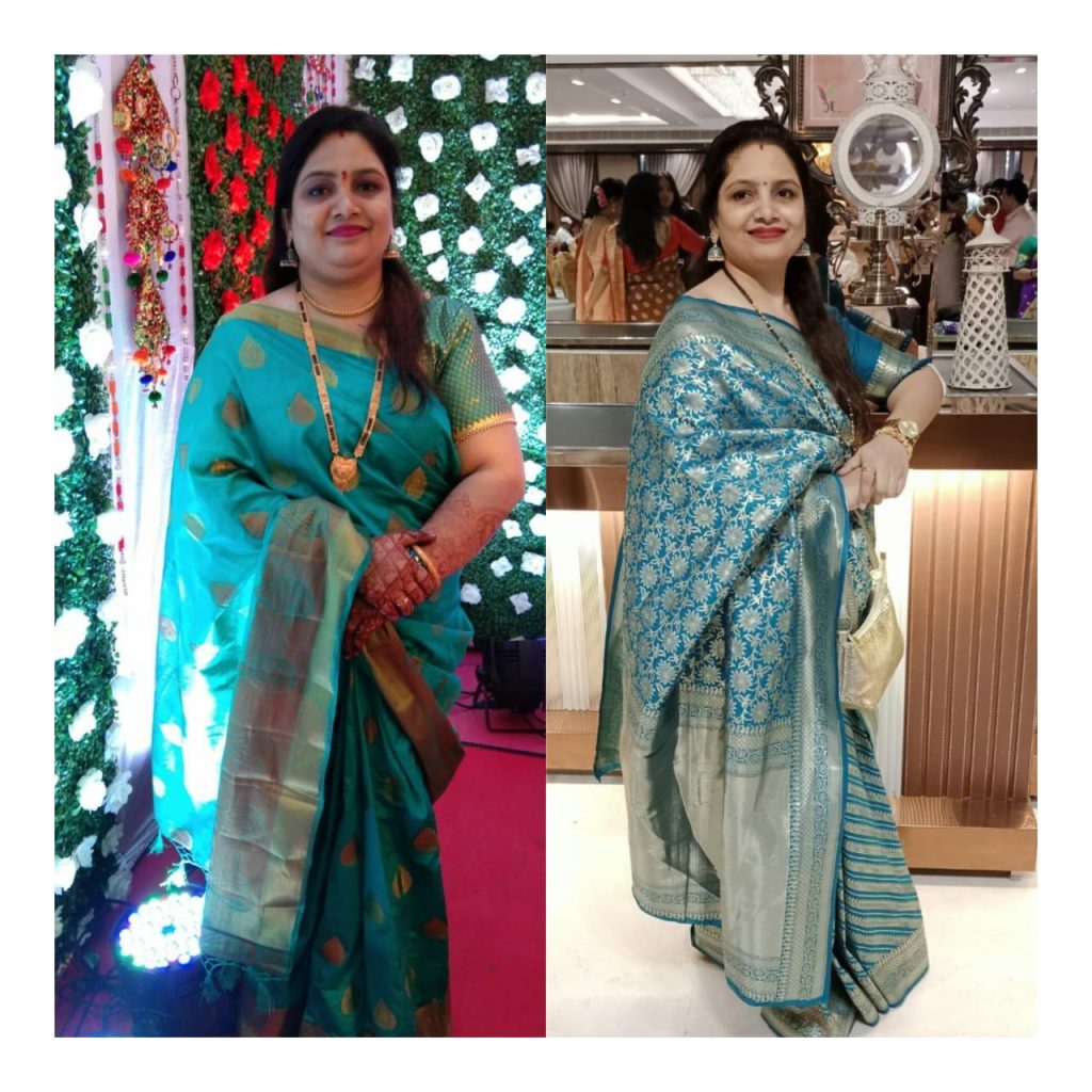 dr-pradeep-tripathi-bariatric-surgery-before-after