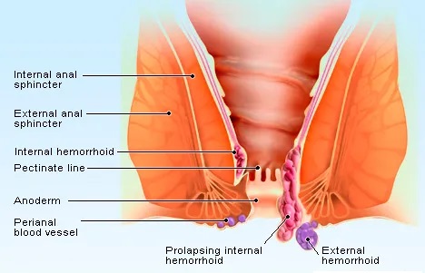 Best Piles Doctor in Thane