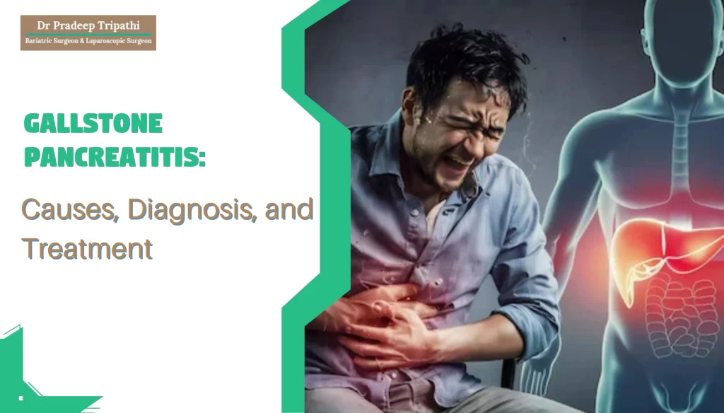 Gallstone Pancreatitis: Causes, Diagnosis and Treatment