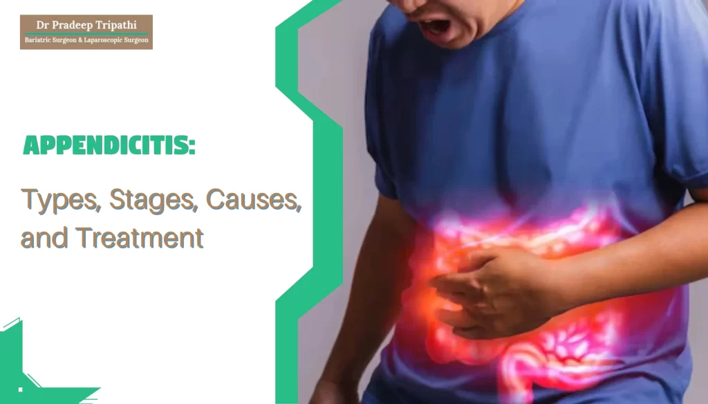 Appendicitis: Types, Stages, Causes, and Treatment